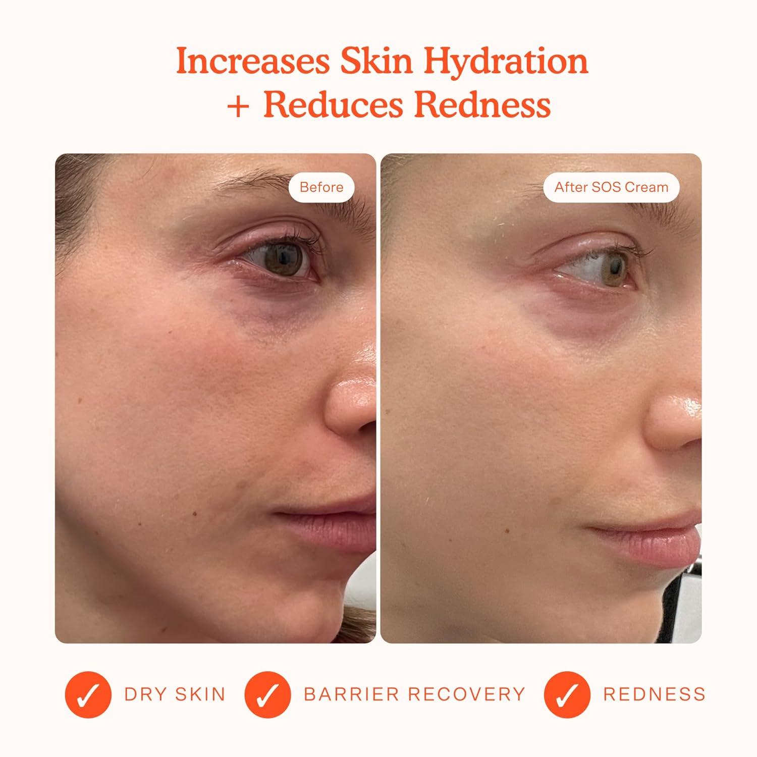 imageTower 28 SOS Recovery Face Cream Hydrating Face Moisturizer with Hyaluronic Acid Ceramides Skin Barrier Repair Moisturizer Reduces Redness Improves Texture Sensitive Skin Care 186 oz