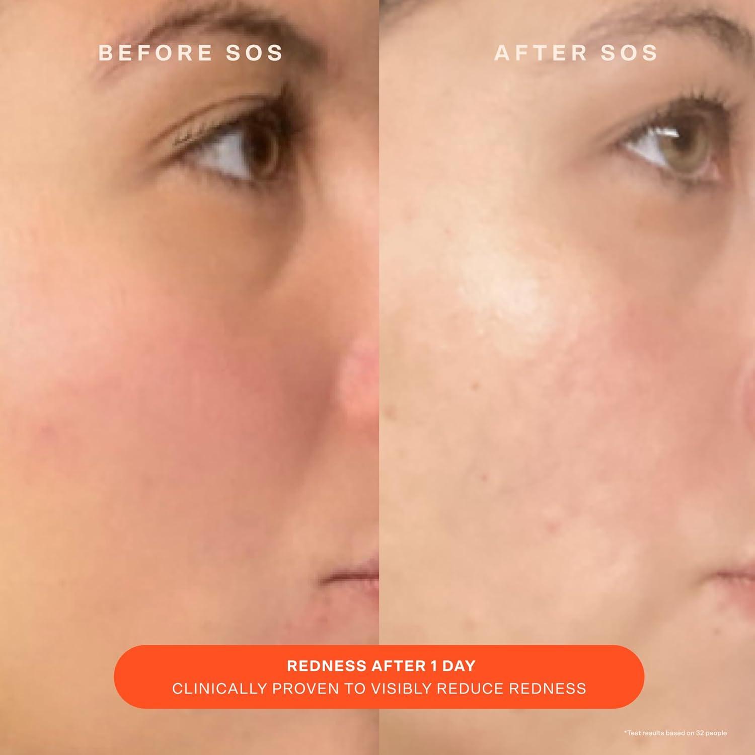 imageTower 28 SOS Daily Rescue Facial Spray 4 FL OZ amp Tower 28 SOS Cream 168 OZ