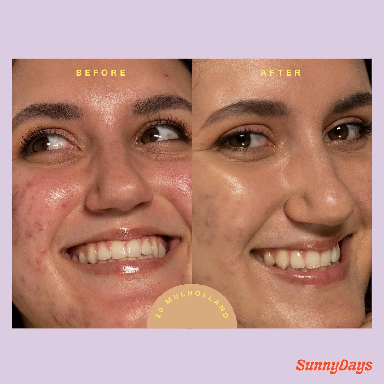 imageTower 28 SunnyDays SPF 30 Tinted Moisturizer 2in1 Buildable Coverage Foundation Mineral Sunscreen for Face Zinc Oxide Aloe amp Prickly Pear for Sensitive Skin 15Light Warm 1 oz20 MULHOLLAND