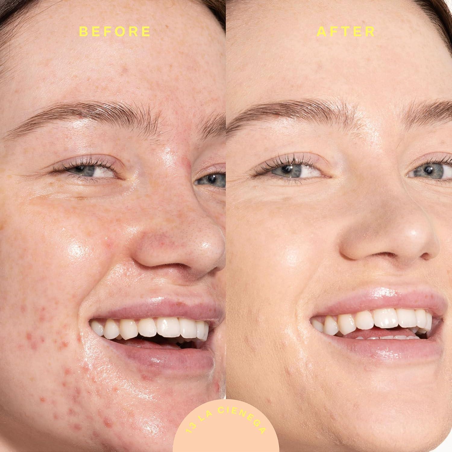 imageTower 28 Swipe Serum Concealer in 30 SunnyDays SPF 30 Tinted Moisturizer in 13 Hydrating MediumFull Coverage Concealer 2in1 Buildable Coverage Foundation Mineral Sunscreen 2 Count