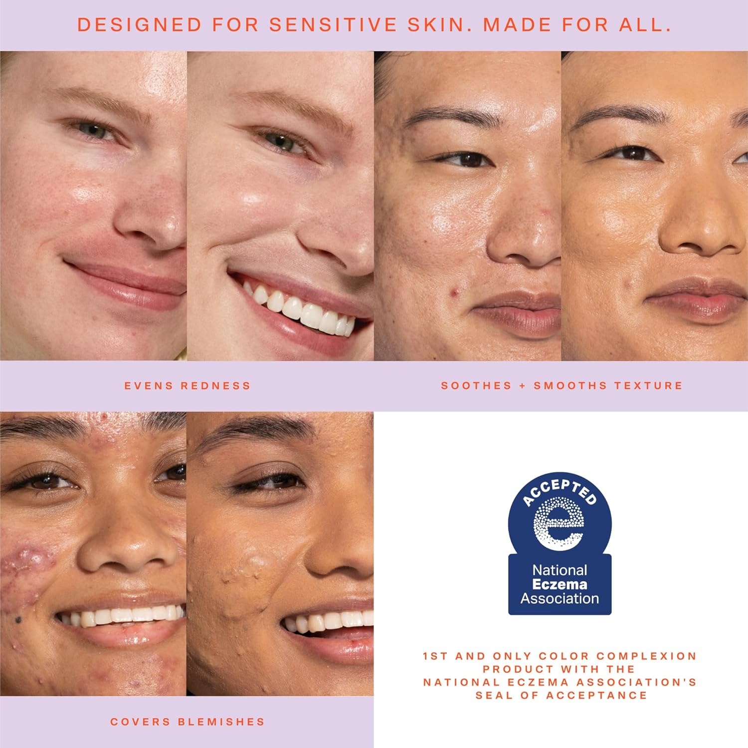 image:imageTower 28 SunnyDays SPF 30 Tinted Moisturizer 2in1 Buildable Coverage Foundation Mineral Sunscreen for Face Zinc Oxide Aloe amp Prickly Pear for Sensitive Skin 18 LightPeach 1 oz55 TEMESCAL