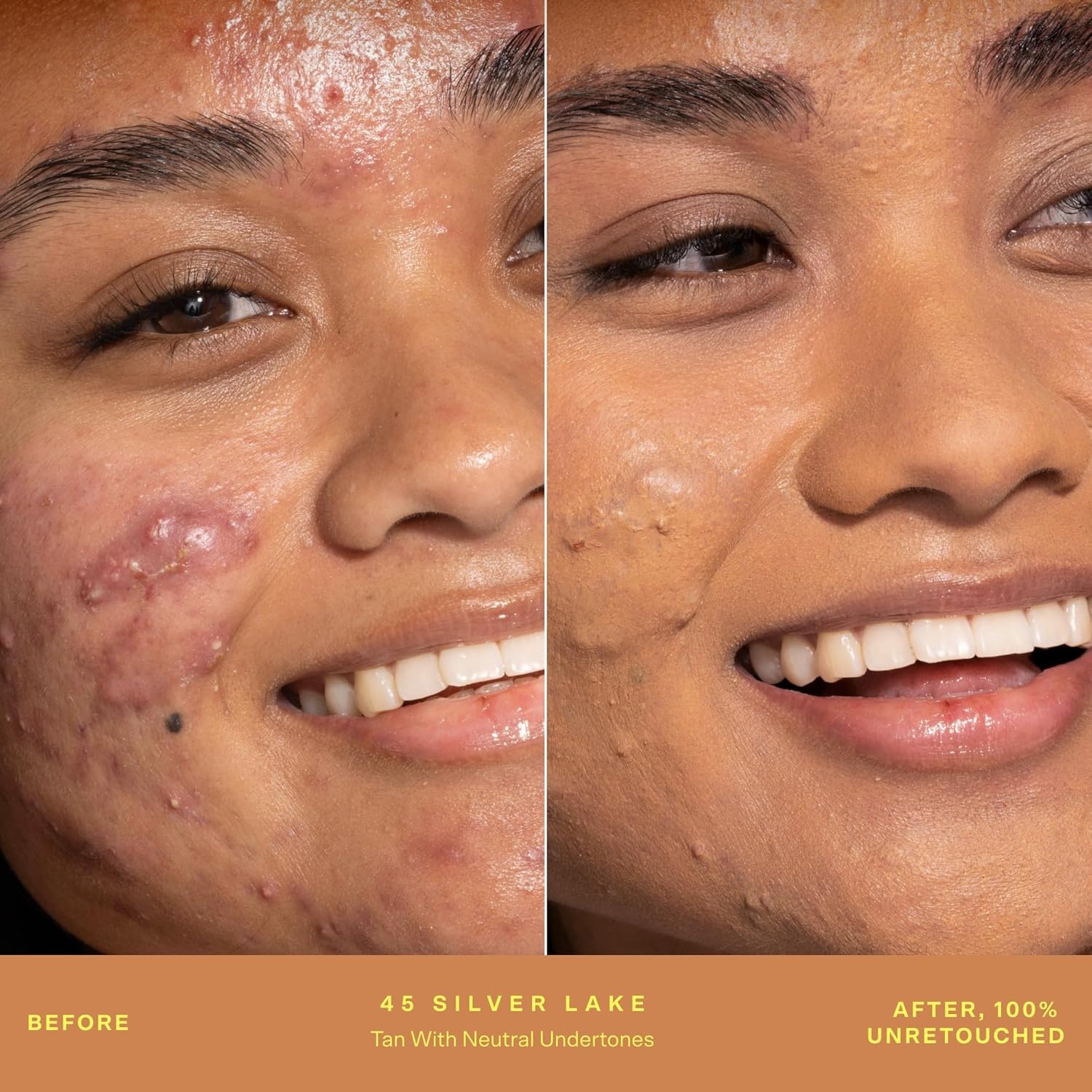 image:imageTower 28 SunnyDays SPF 30 Tinted Moisturizer 2in1 Buildable Coverage Foundation Mineral Sunscreen for Face Zinc Oxide Aloe amp Prickly Pear for Sensitive Skin 18 LightPeach 1 oz45 SILVER LAKE