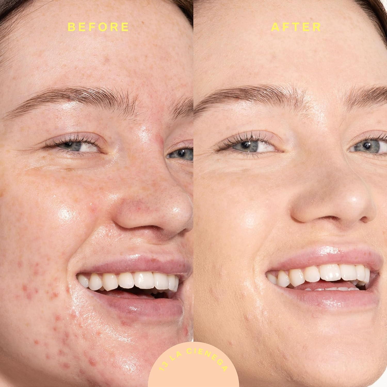 image:imageTower 28 SunnyDays SPF 30 Tinted Moisturizer 2in1 Buildable Coverage Foundation Mineral Sunscreen for Face Zinc Oxide Aloe amp Prickly Pear for Sensitive Skin 18 LightPeach 1 oz13 La Cienega